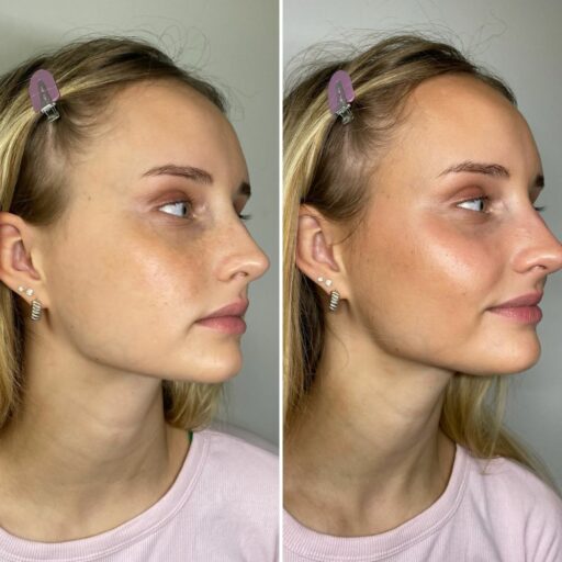 Easy Skin Glow-Up - image 5